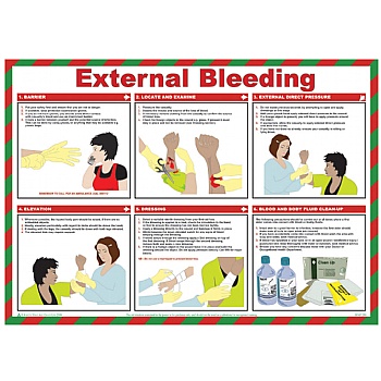 External Bleeding Poster | Cheap External Bleeding Poster from our ...